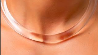 Acrylic Necklace